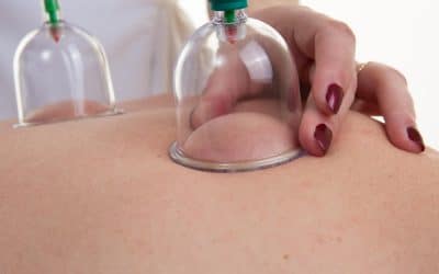 What does cupping do for your body?